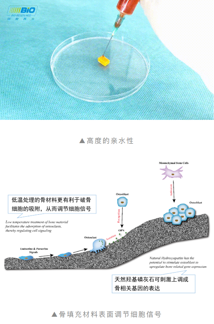 重磅上市！傲塑口腔颌骨骨再生产品 | 国内首款复合透明质酸天然骨填充材料